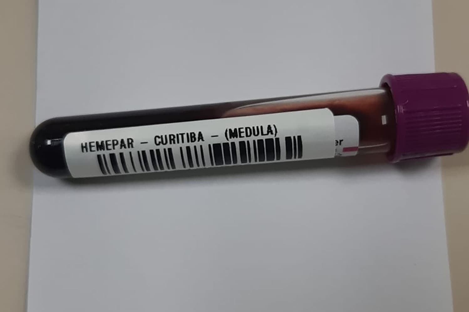 Fevereiro Laranja: mês da conscientização sobre leucemia reforça papel do diagnóstico